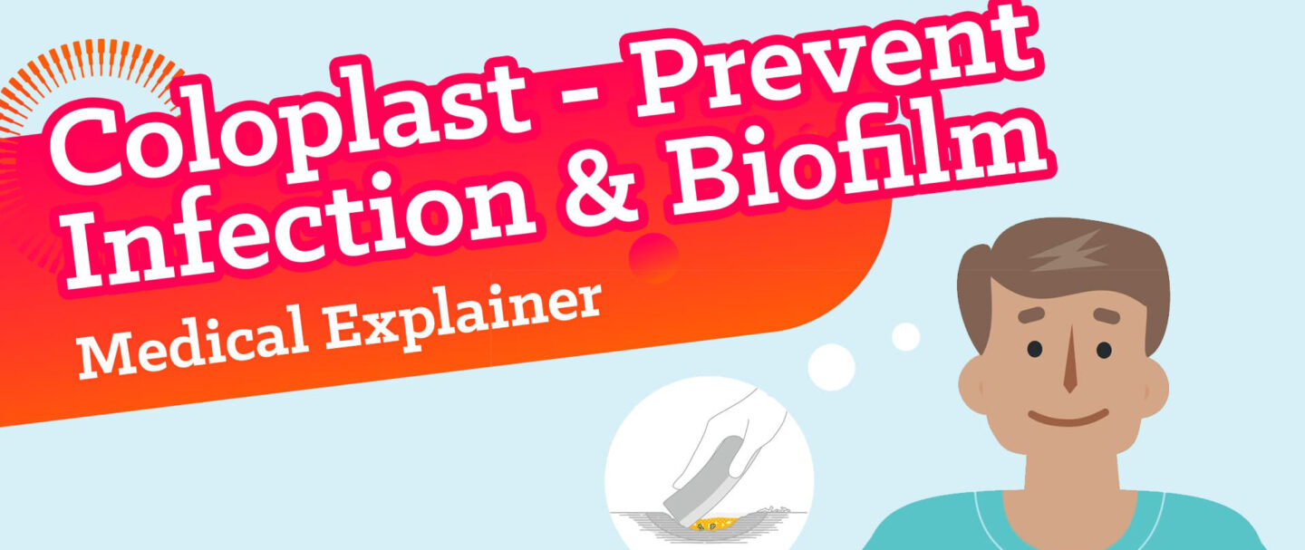 Die animierten Coloplast Videos sind healthcare Explainer (Erklärfilme) und Produktfilme. Das Titelbild